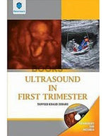 Load image into Gallery viewer, Ultrasound in First Trimester w/ CD