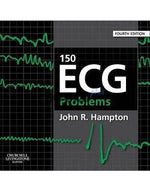 Load image into Gallery viewer, 150 ECG Problems 4th Edition