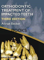 Load image into Gallery viewer, Orthodontic Treatment of Impacted Teeth 3rd Edition