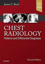 Load image into Gallery viewer, Chest Radiology: Patterns and Differential Diagnoses Hardcover – 15 December 2017