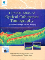 Load image into Gallery viewer, Clinical Atlas of Optical Coherence Tomography