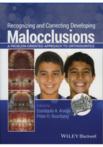 Load image into Gallery viewer, Recognizing and Correcting Developing Malocclusions A Problem Oriented Approach to Orthodontics