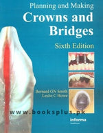 Load image into Gallery viewer, Smiths Planning and Making Crown and Bridges