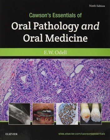 Cawson&#8217;s Essentials of Oral Pathology and Oral Medicine 9th Edition