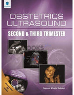 Load image into Gallery viewer, Obstetrics Ultrasound Second and Third Trimester
