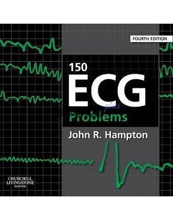 150 ECG Problems 4th Edition