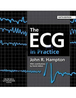 Load image into Gallery viewer, The ECG in Practice 6th Edition
