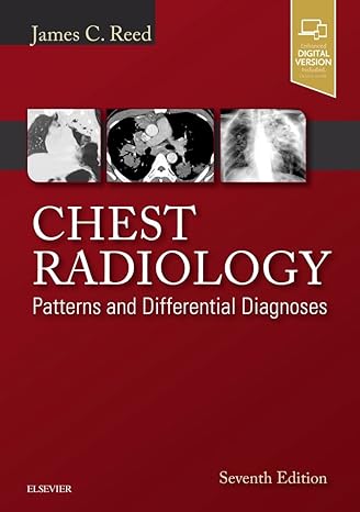 Chest Radiology: Patterns and Differential Diagnoses Hardcover – 15 December 2017