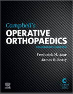 Load image into Gallery viewer, Campbell&#39;s Operative Orthopaedics, 4-Volume Set
