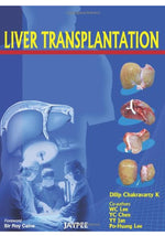 Load image into Gallery viewer, Liver Transplantation 1st Edition, Kindle Edition