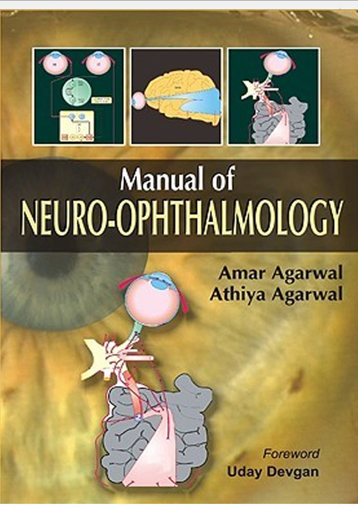 Manual of Neuro Ophthalmogy