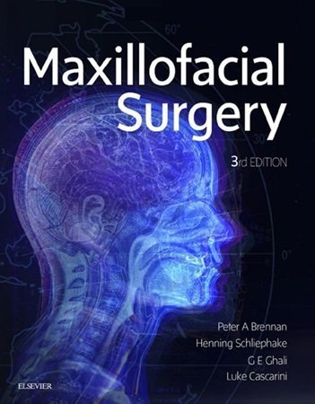 Maxillofacial Surgery 3rd Edition 2 Volume Set