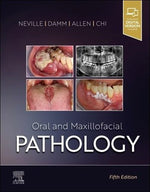 Load image into Gallery viewer, Oral and Maxillofacial Pathology 5th Edition
