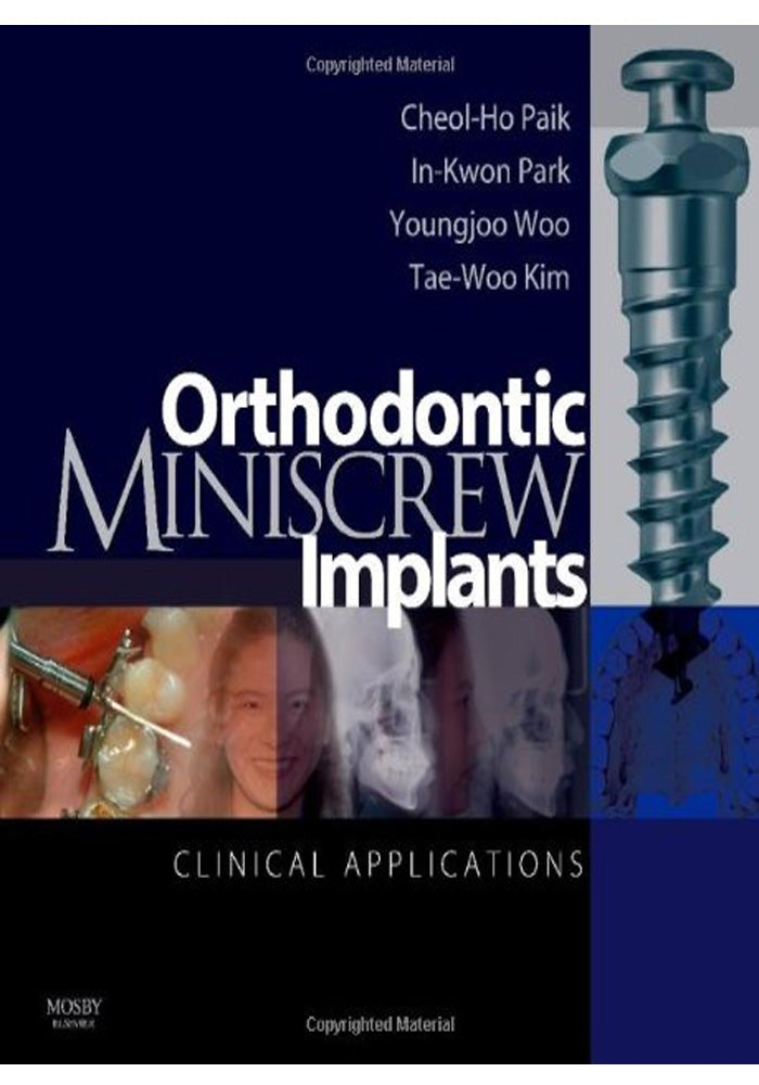 Orthodontic Miniscrew Implants Clinical Applications