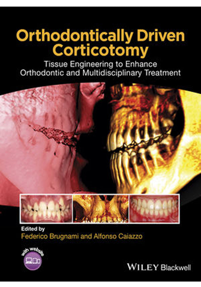 Orthodontic Treatment Mechanics and the Preadjusted Appliance