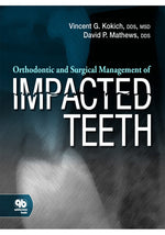 Load image into Gallery viewer, Orthodontic and Surgical Management of Impacted Teeth
