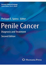 Load image into Gallery viewer, Penile Cancer: Diagnosis and Treatment (Current Clinical Urology) 2nd Edition, Kindle Edition
