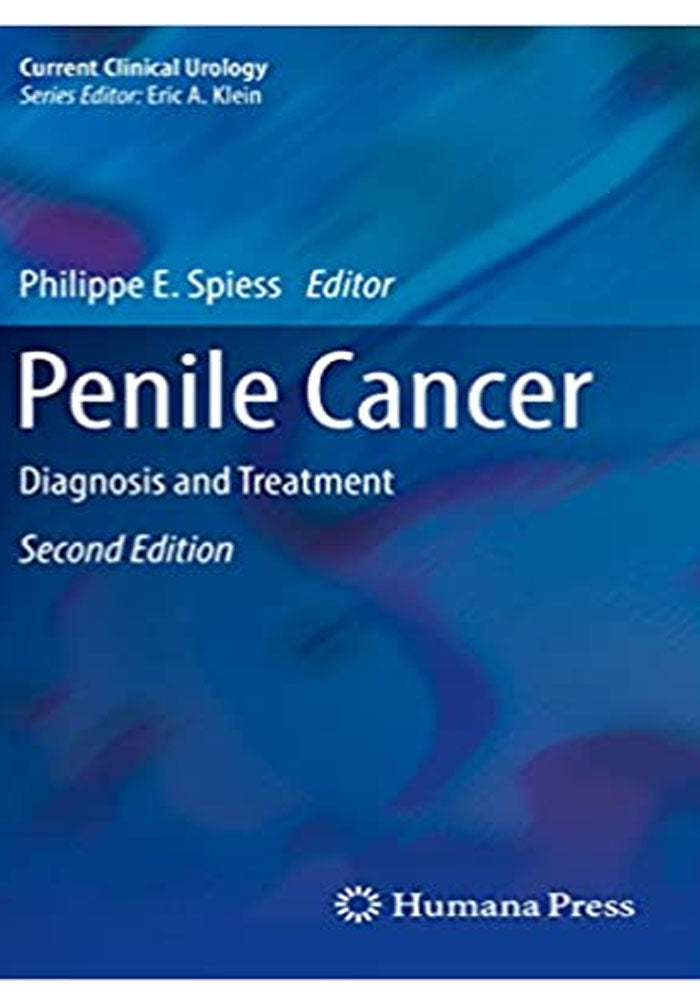 Penile Cancer: Diagnosis and Treatment (Current Clinical Urology) 2nd Edition, Kindle Edition