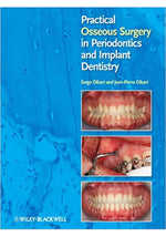 Load image into Gallery viewer, Practical Osseous Surgery in Periodontics and Implant Dentistry 1st Edition
