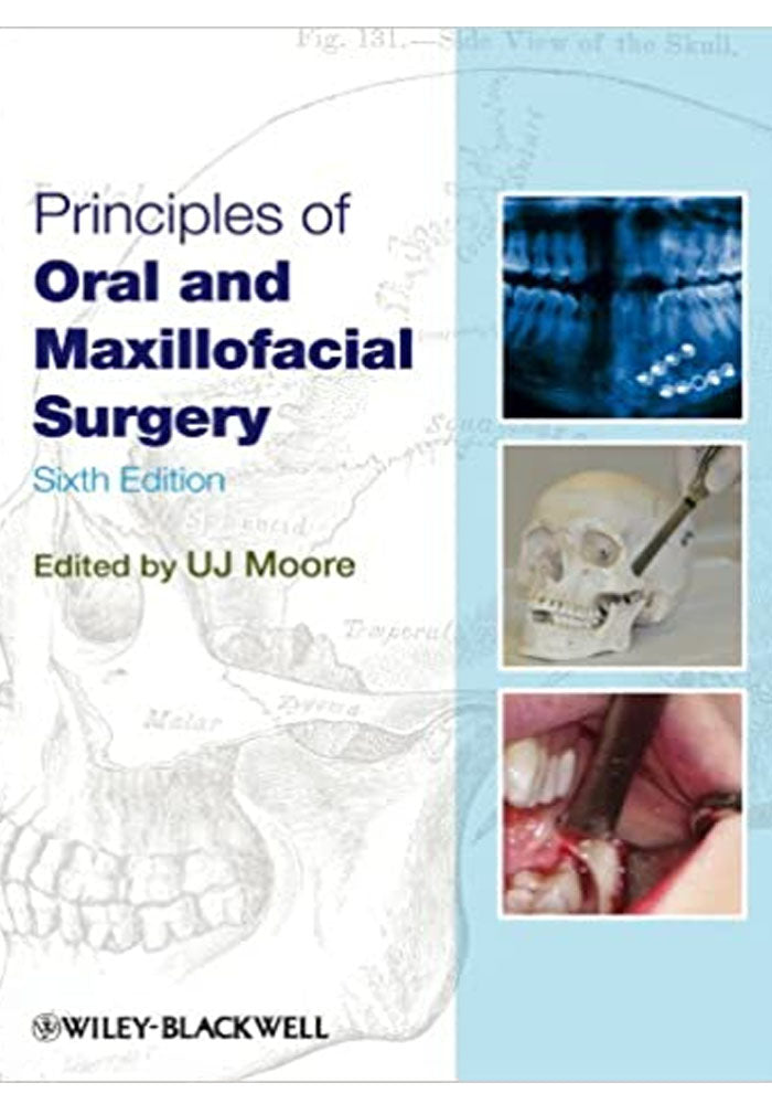 Principles of Oral and Maxillofacial Surgery 6th Edition, Kindle Edition