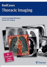 Load image into Gallery viewer, Radcases Thoracic Imaging (Radcases Plus Q&amp;A) 1st Edition