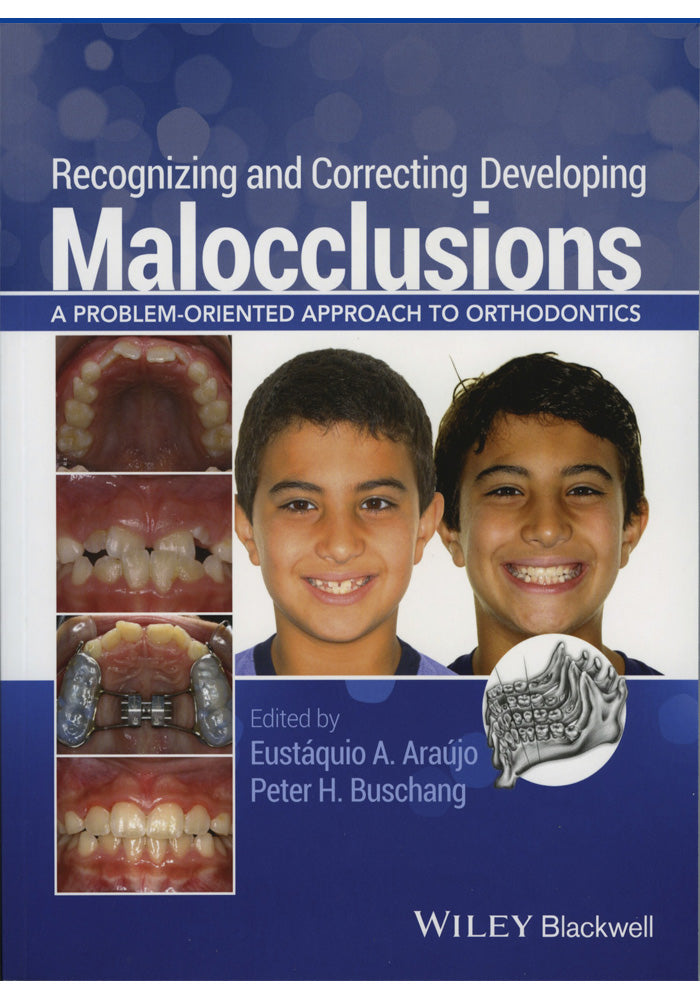 Recognizing and Correcting Developing Malocclusions A Problem Oriented Approach to Orthodontics