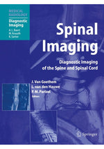 Load image into Gallery viewer, Spinal Imaging: Diagnostic Imaging of the Spine and Spinal Cord (Medical Radiology) 1st Edition

