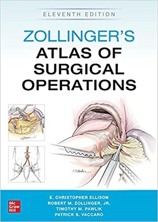 Zollingers Atlas of Surgical Operations