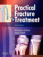 Load image into Gallery viewer, Practical Fracture Treatment 5th Edition
